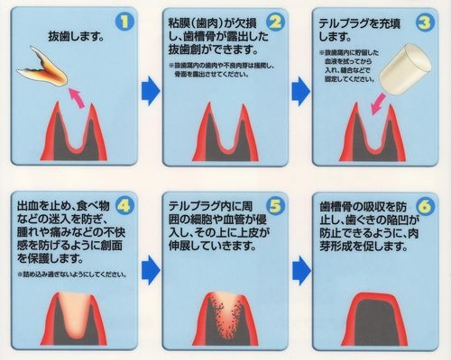 https://sdcg.xsrv.jp/mw-kamiooka/asset/E78CAB20-20E382B3E38394E383BC-d45c4.jpg