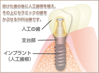 https://sdcg.xsrv.jp/mw-kamiooka/asset/img54b1.jpg